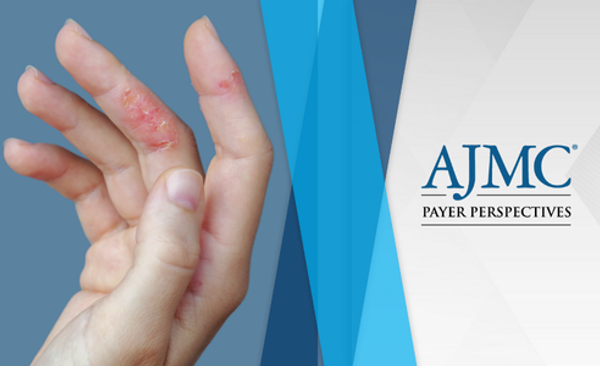 Topical Therapies for the Treatment of Atopic Dermatitis: Balancing Safety, Efficacy, and Access