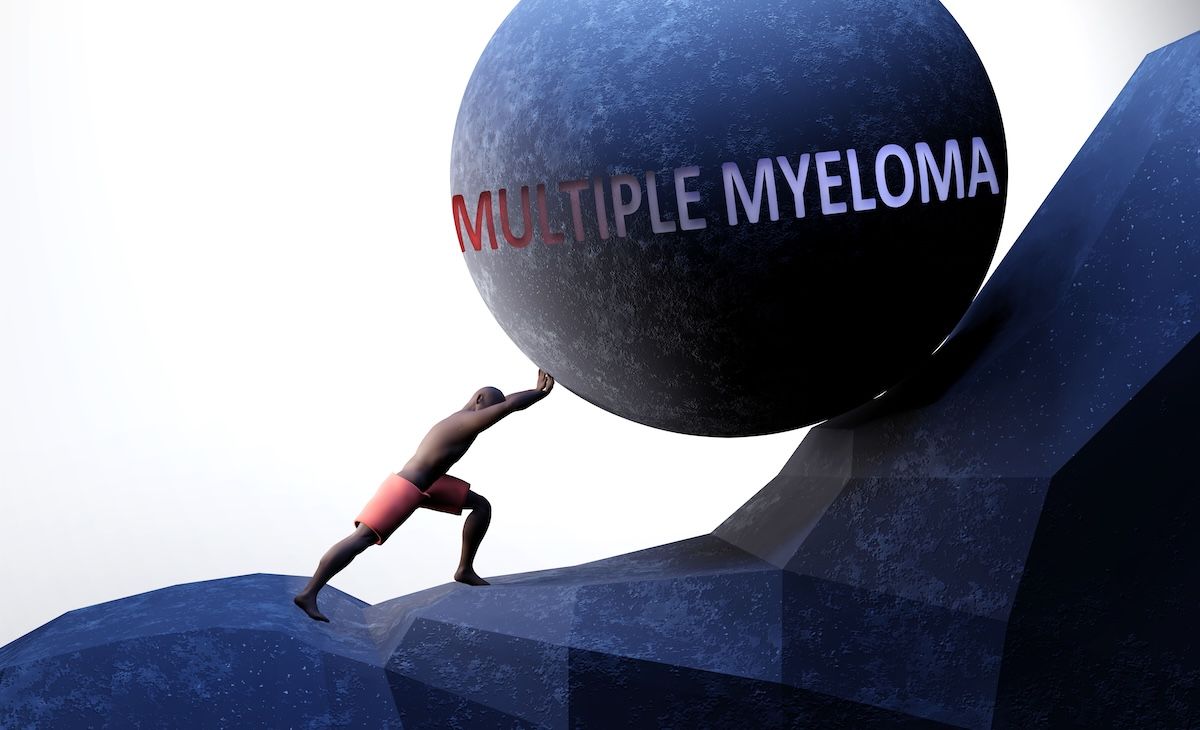 Multiple myeloma | Image Credit: © GoodIdeas - stock.adobe.com