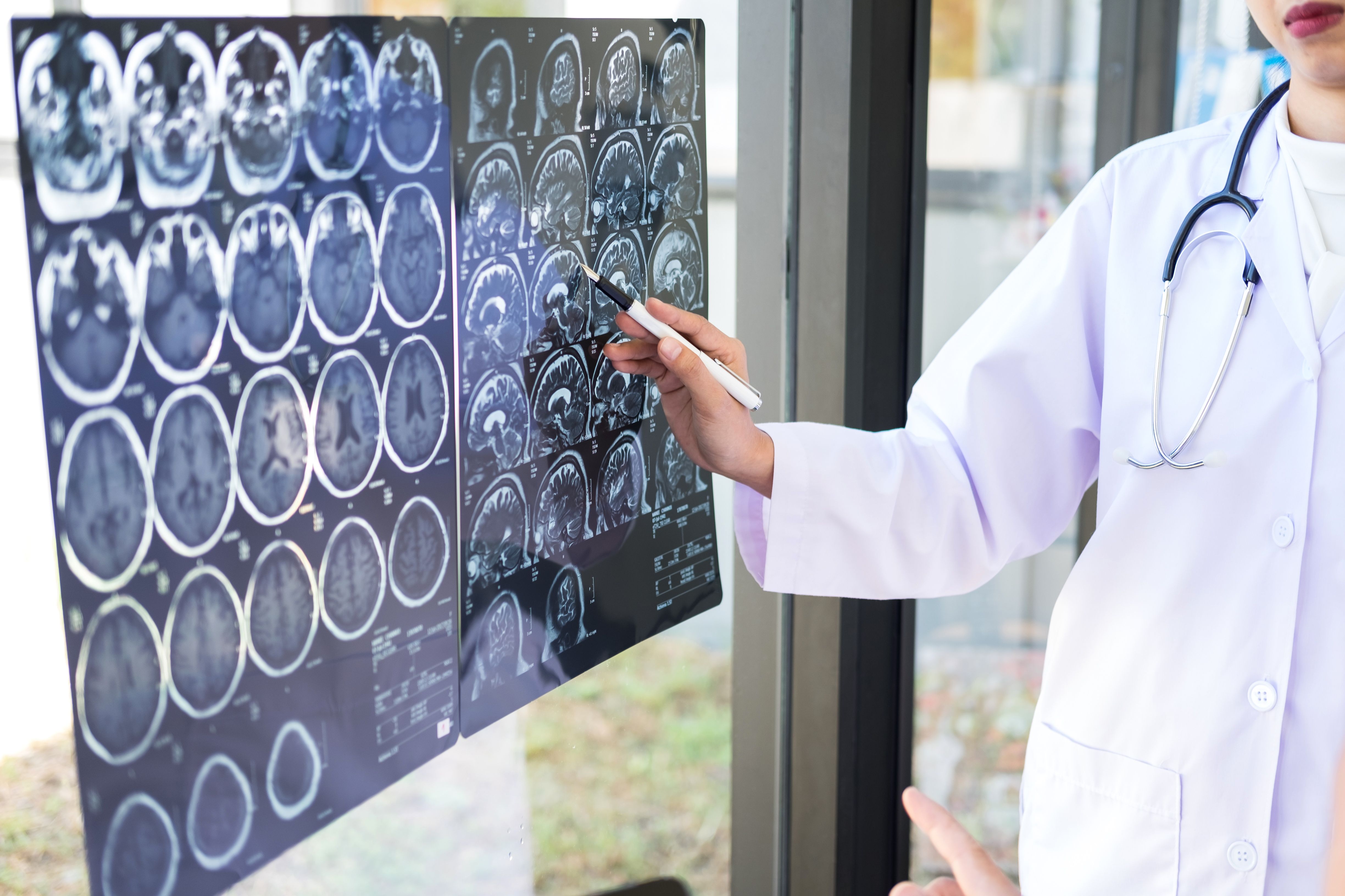 Professor Doctor discussing and consulting method with patient treatment results on brain x-ray film About the problem of the patient | Image credit: Freedomz - stock.adobe.com