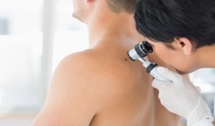 Image of exam for skin cancer