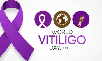 Vitiligo Awareness Month. | Image Credit: Waseem Ali Khan -  stock.adobe.com 