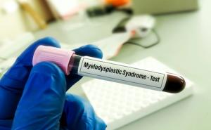There was significant variability in test frequency and detection rates among patients with AML and MDS. | Image credit: Saiful52-stock.adobe.com