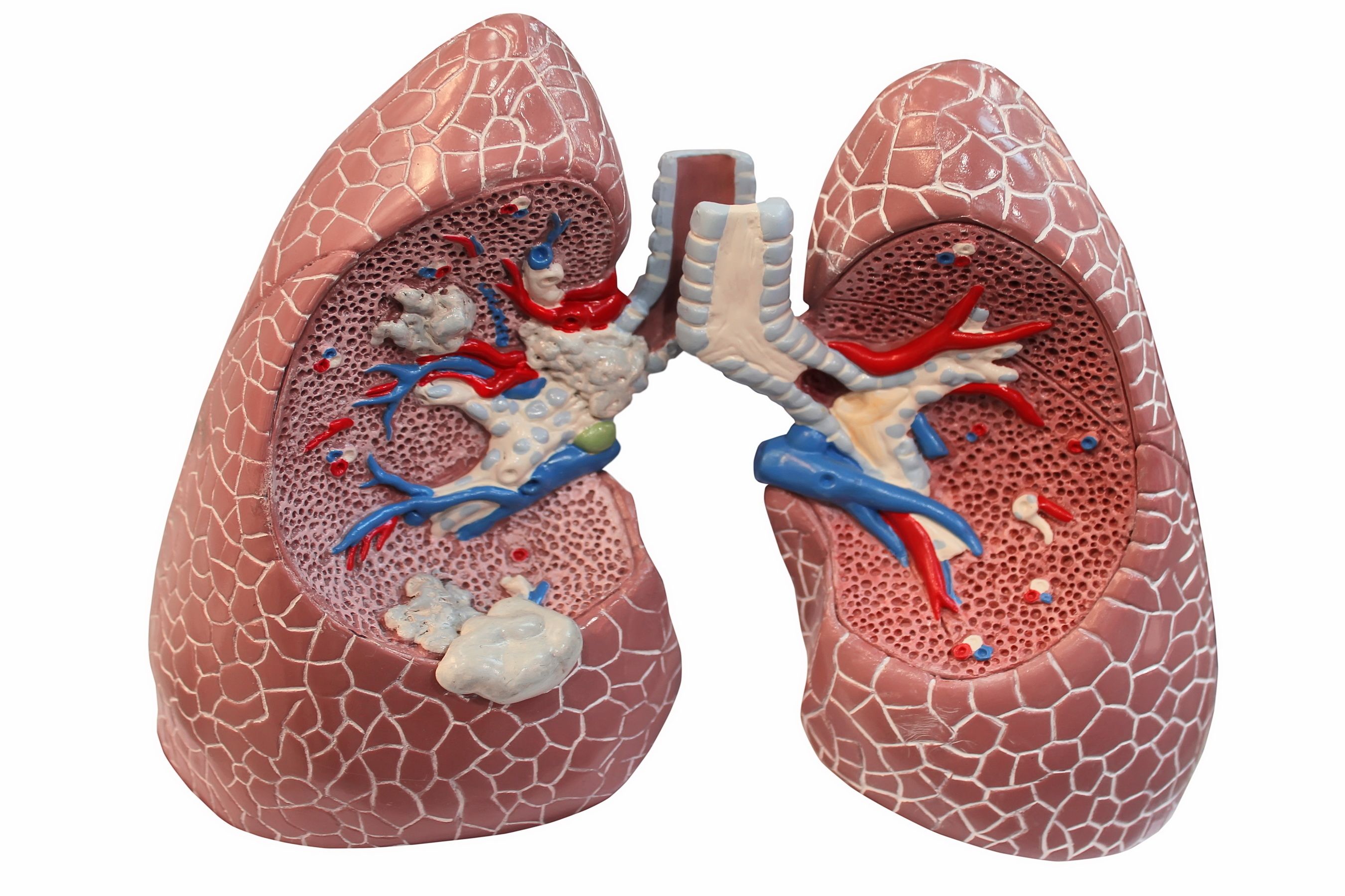 Lungs