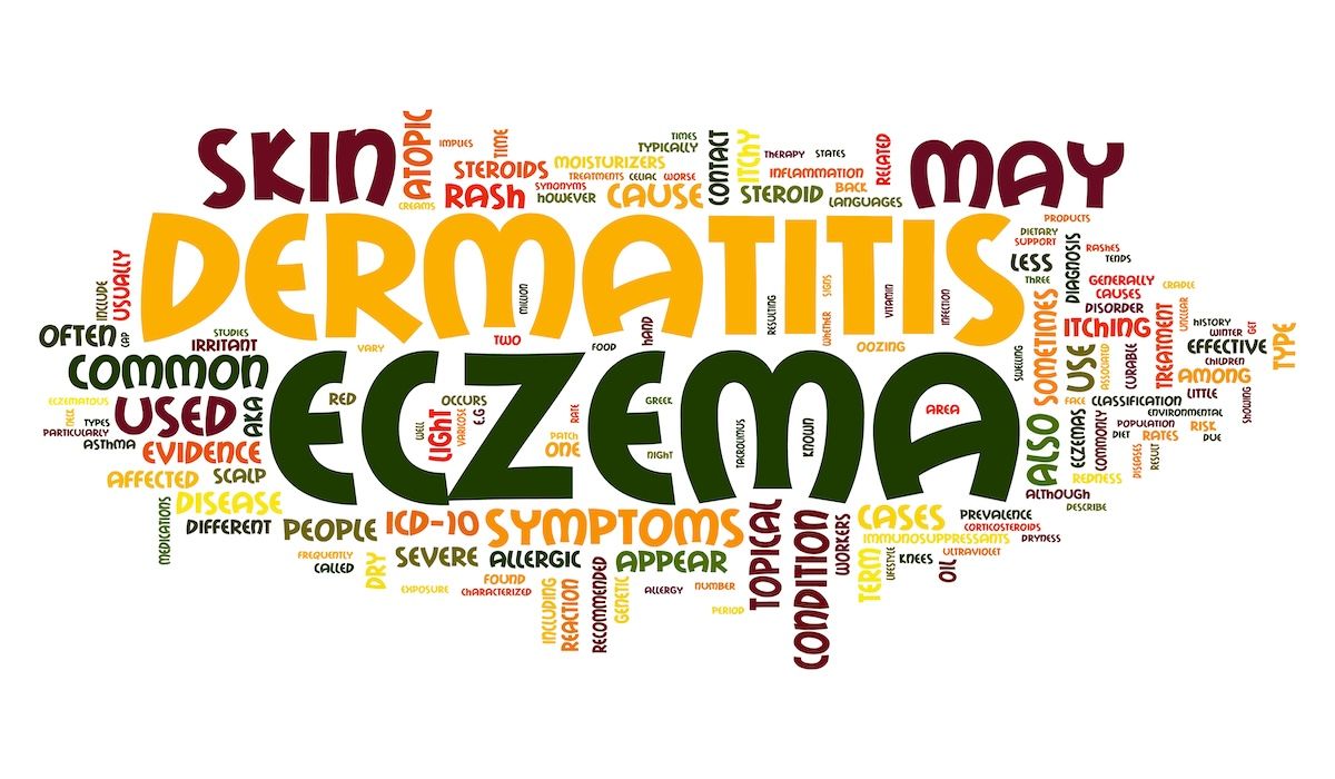 Dermatitis word cloud  | Image Credit: © Words Collage Cloud-stock.adobe.com
