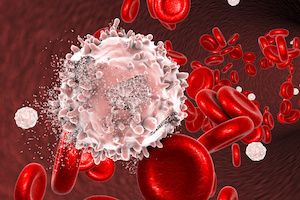 Early Study Promising for Ruxolitinib, Decitabine for Myeloproliferative Neoplasms