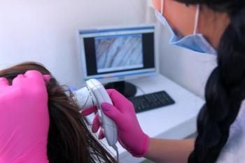 Trichoscopy | Image Credit: familylifestyle - stock.adobe.com  