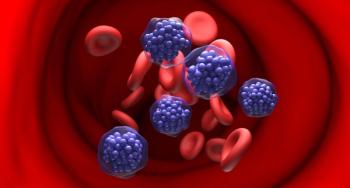 dlbcl nhl lymphoma cells detailed | Image credit: LASZLO - stock.adobe.com