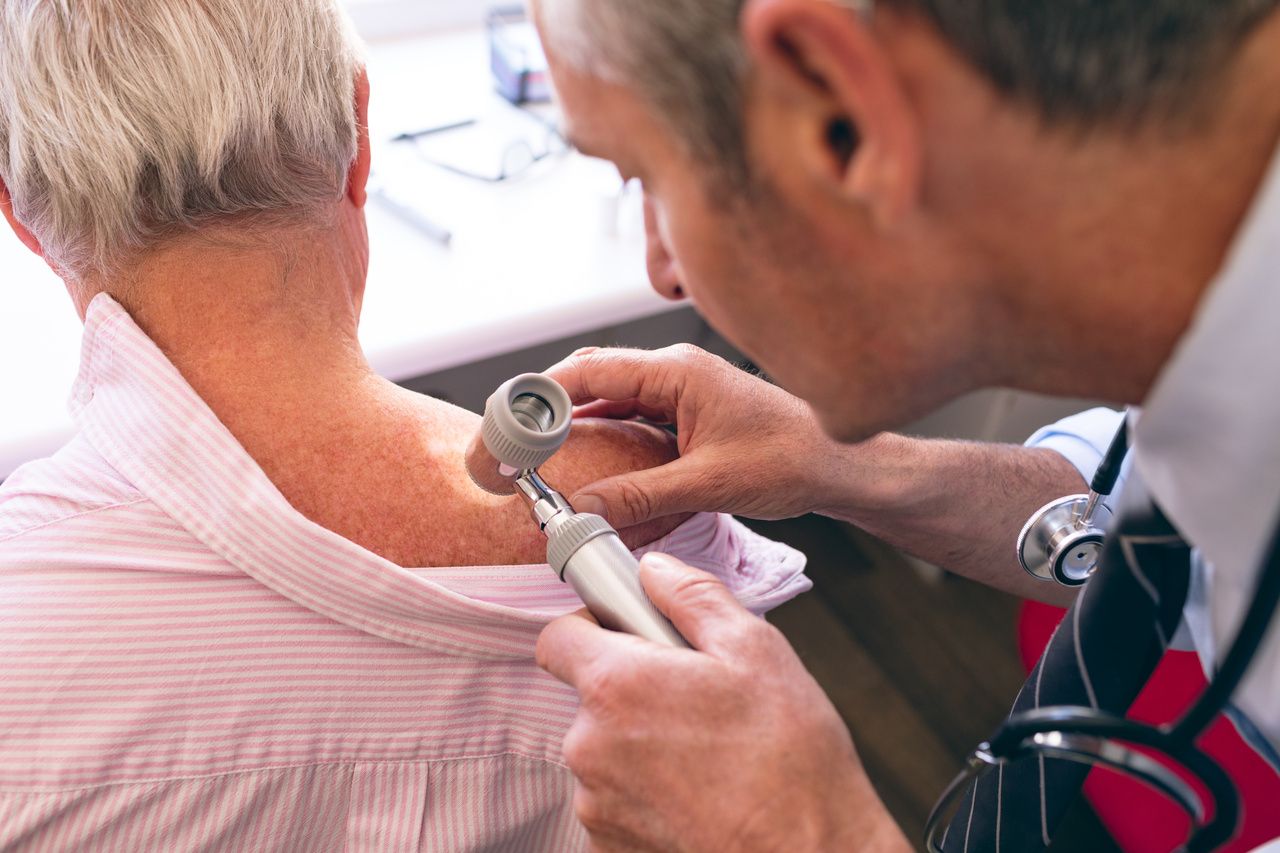 Doctor examining skin for cancer