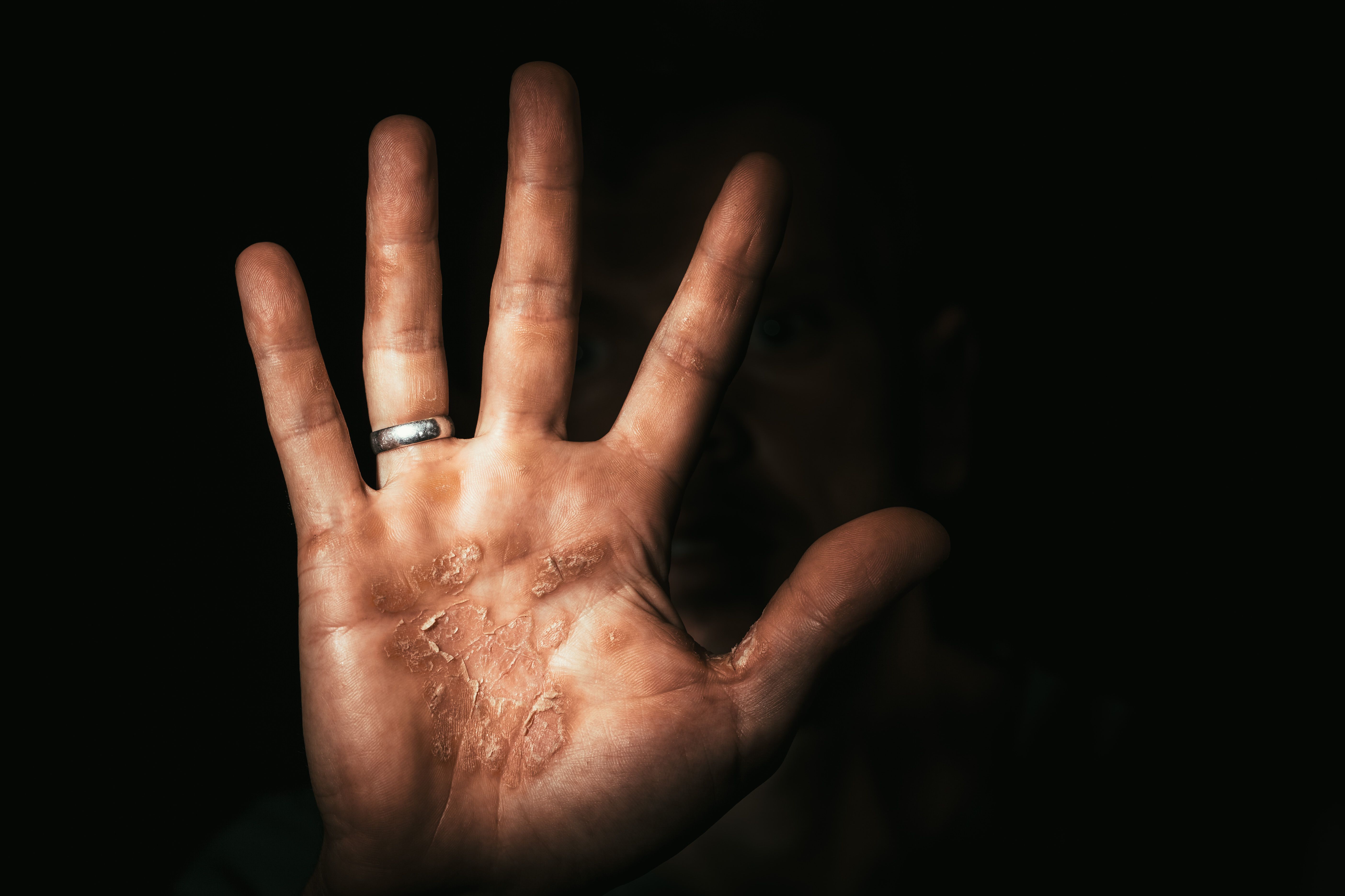 dark hand of a worker with b calluses protests. Stop | vovan - stock.adobe.com