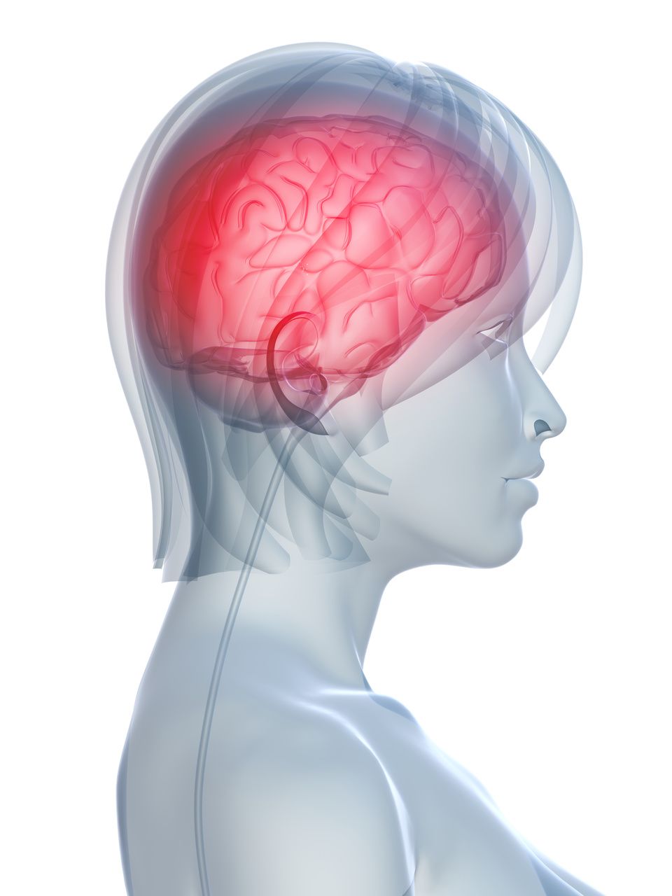 Migraineurs Exhibit Unique Sensory Responses to Stimuli