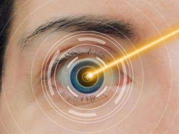Laser eye surgery | Image credit: cabado - stock.adobe.com