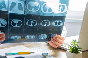 Doctor looking at lung imaging | Image credit: shidlovski – stock.adobe.com