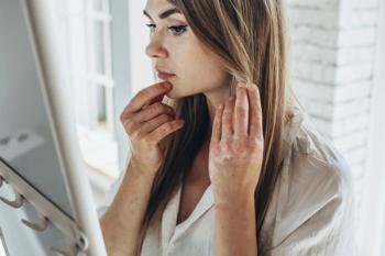 Psoriasis. Acute psoriasis on the knees, body, elbows is an autoimmune, incurable dermatological skin disease | nuzza11 - stock.adobe.com