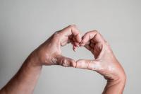 Vitiligo. | Image Credit: JoseManuel - stock.adobe.com