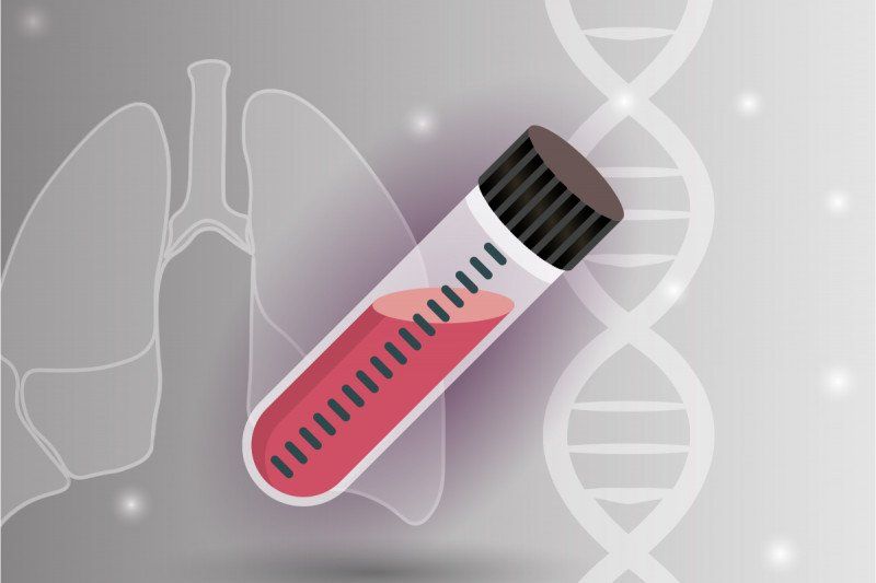 liquid biopsy