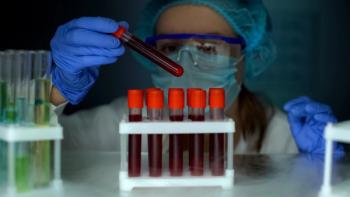 Bloodserum | Image Credit: © motortion-stock.adobe.com