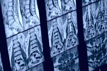 Spine MRI - Kondor83 - stock.adobe.com
