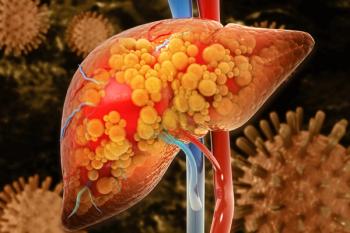 HCC is the most common type of liver cancer, and it typically occurs in patients with chronic liver conditions. | Image Credit: Crystal light - stock.adobe.com