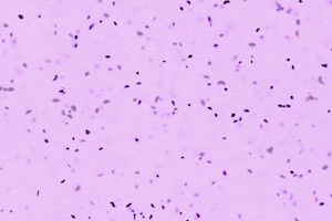 Two Studies Evaluate Non-Tuberculous Mycobacterium Causes and Identification