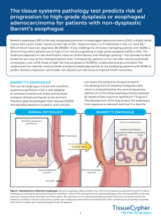 The Tissue Systems Pathology Test Predicts Risk of Progression to High-Grade Dysplasia or Esophageal Adenocarcinoma for Patients With Non-Dysplastic Barrett's Esophagus