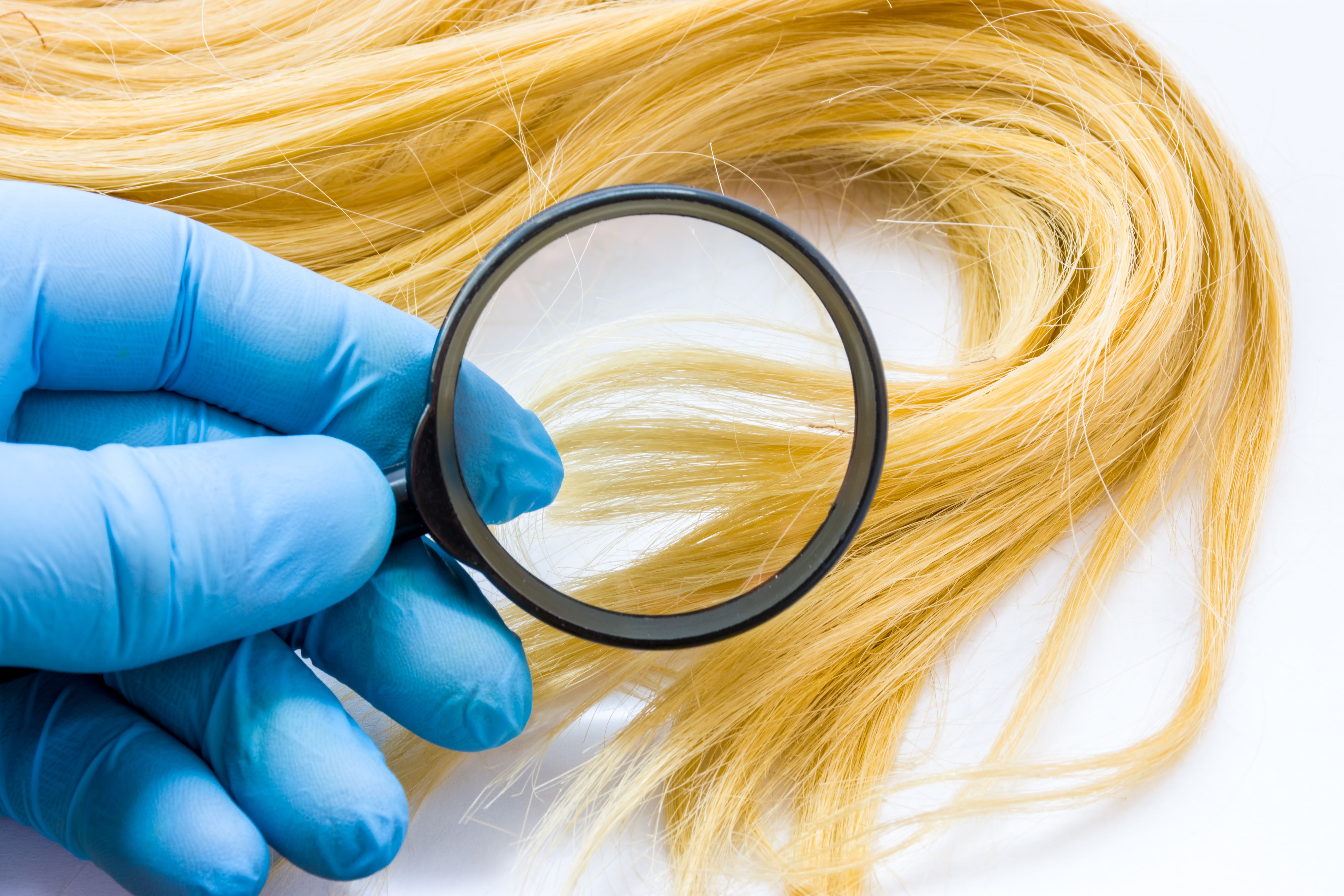 Dermatologist examines hair breakage | Image Credit: shidlovski - stock.adobe.com