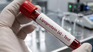 Lp(a) testing | Image credit: HunterStock - stock.adobe.com