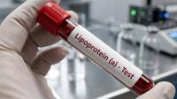 Lp(a) testing | Image credit: HunterStock - stock.adobe.com