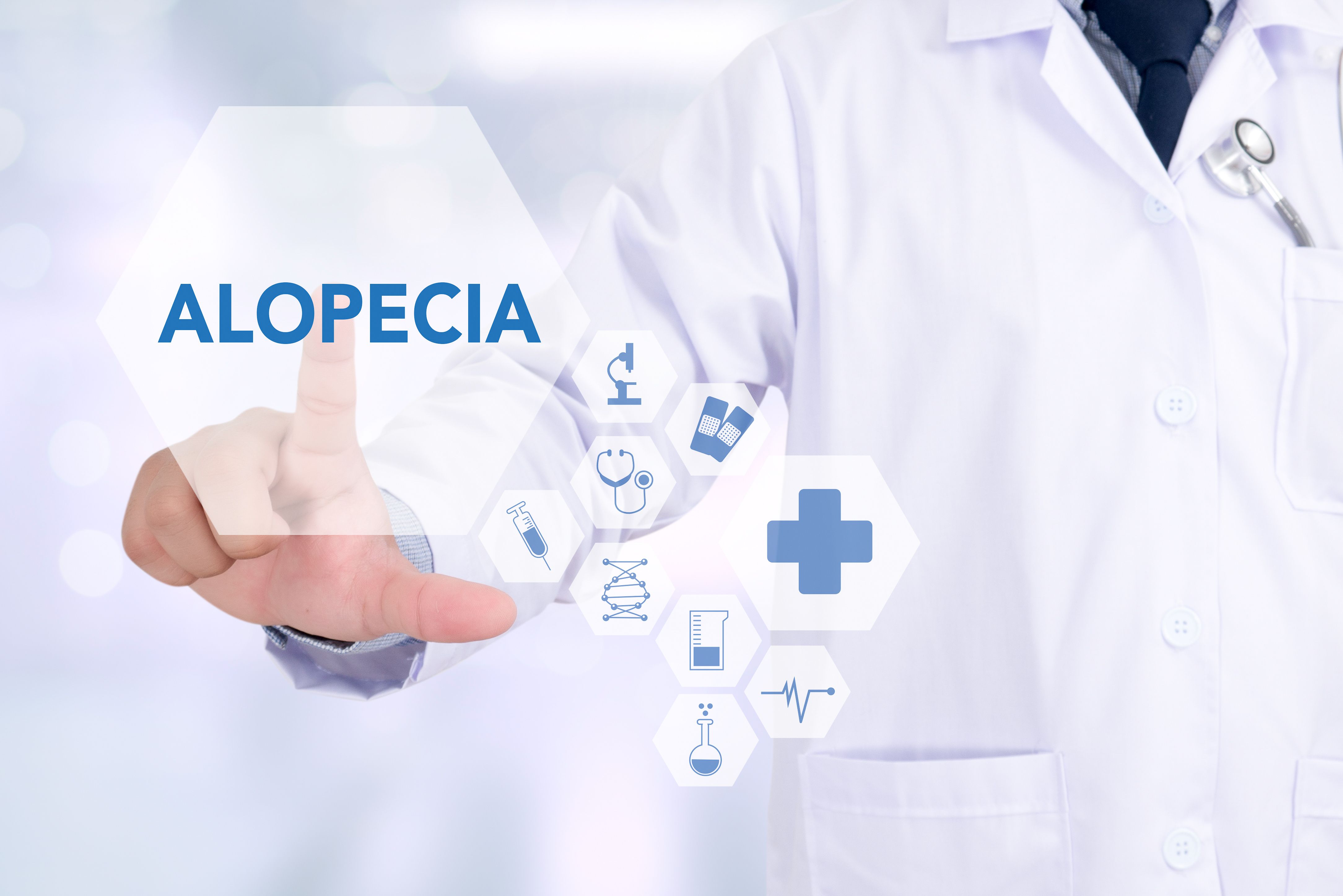 One of the most promising findings from the study was the identification of potential biomarkers in alopecia areata. | Image Credit: onephoto - stock.adobe.com 