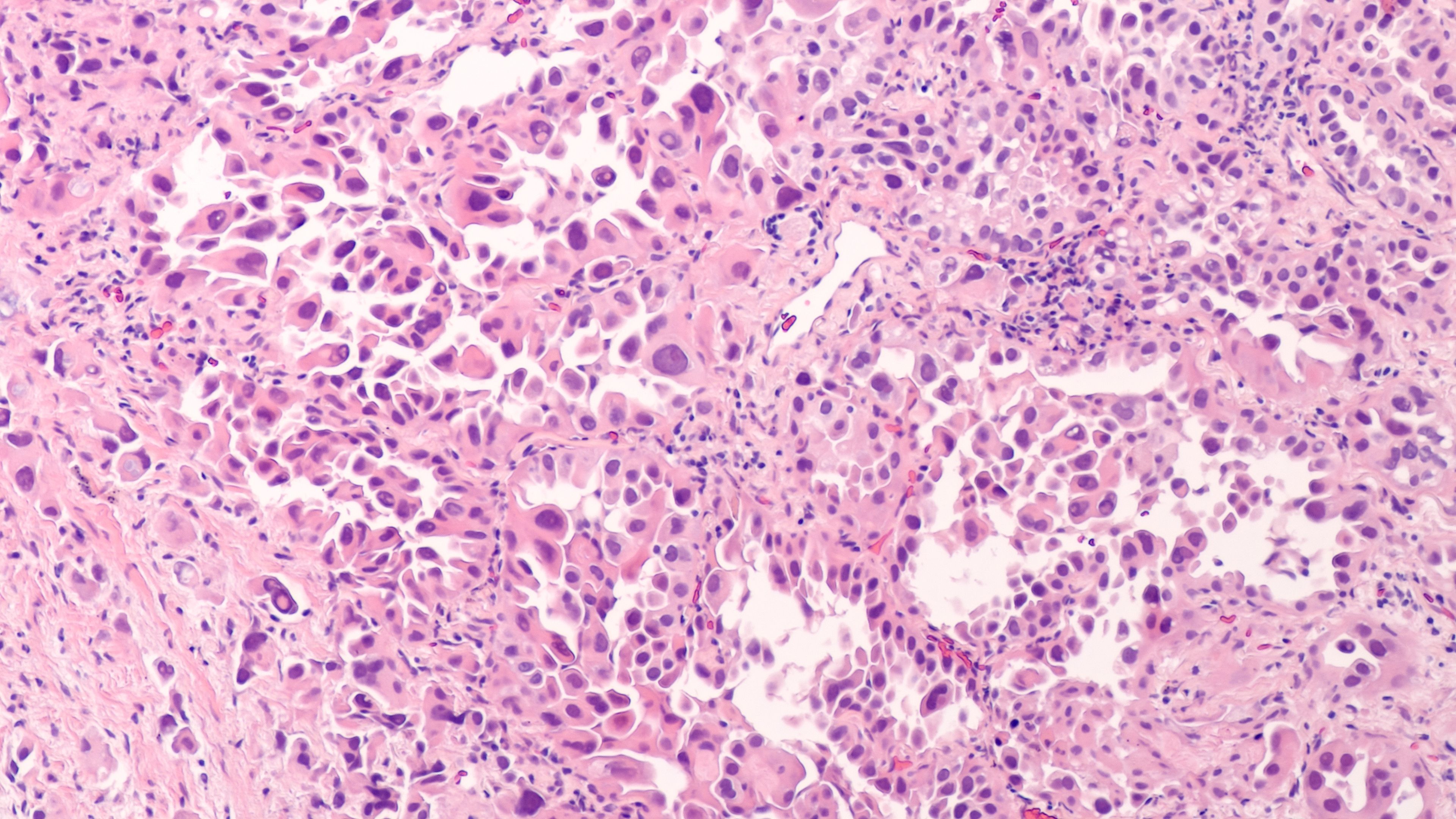 Current and Emerging Options for Uncommon EGFR- and Exon 20 Insertion–Mutated NSCLC