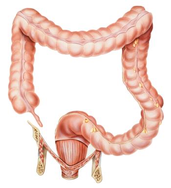 A new AI device is aimed at helping GIs find areas of the colon that need further evaluation for possible cancer.