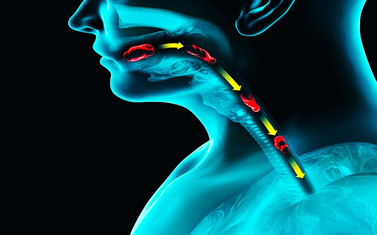 Disorders of swallowing, dysphagia. Pharyngeal and esophageal dysphagia. Oral phase. The path of food, the act of swallowing. Person ia x-ray, 3d render: © Naeblys - stock.adobe.com