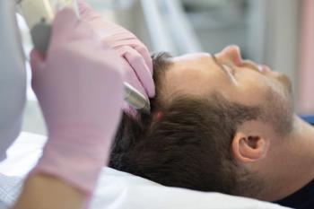 Dermatologist conducts laser therapy. | Image Credit: Tetiana - stock.adobe.com