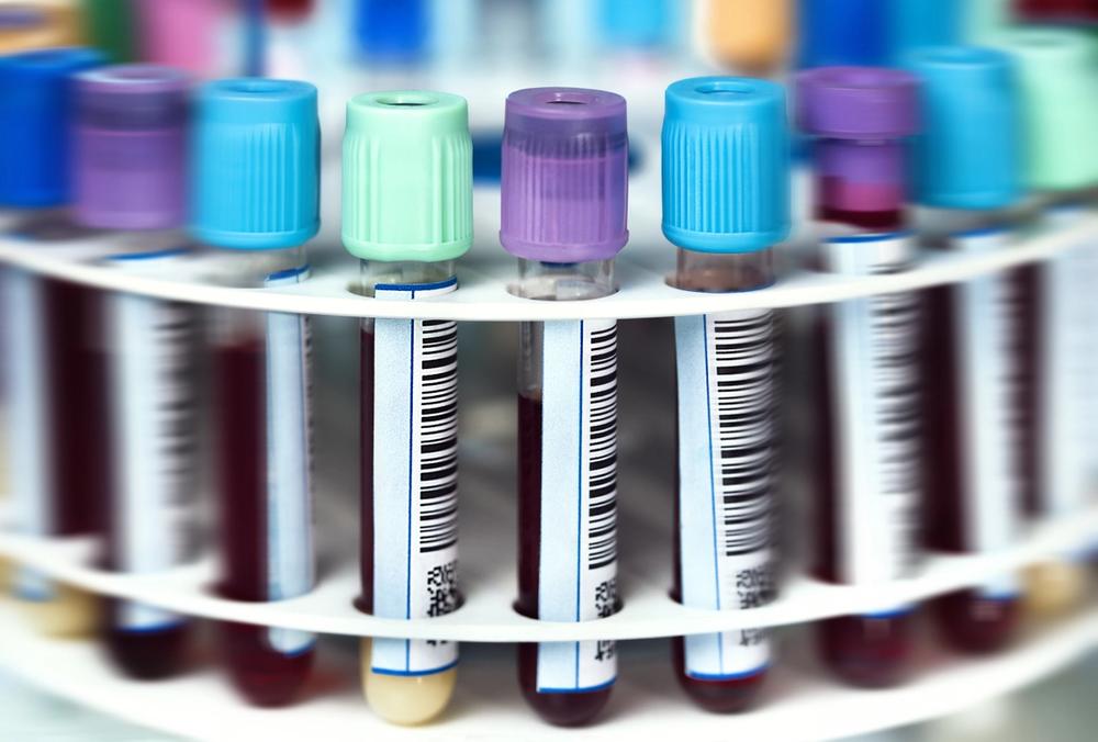 Image of test tubes filled with blood in a lab