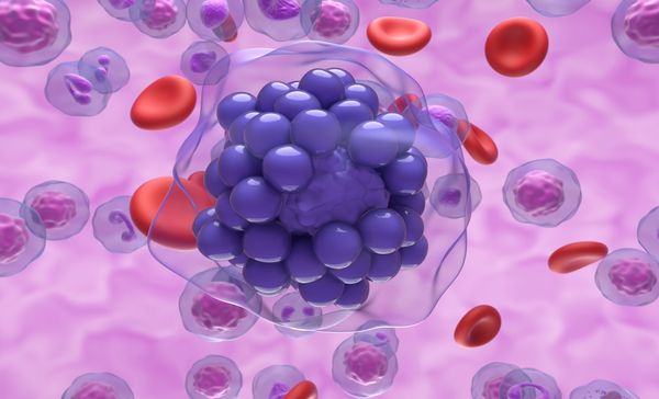 The review also shows that more work is needed, especially related to radiation’s impacts by IPI score and in patients with bulky disease. | Image credit: laszlo – stock.adobe.com