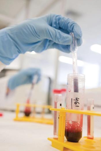 Bone marrow transplant