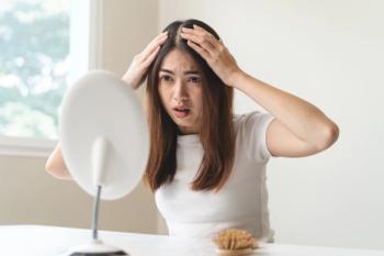Worried woman looking at scalp | Image Credit: Pormezz - stock.adobe.com
