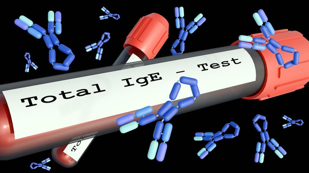 ImmunoglobulinE-Love Employee | Image Credit: © stock.adobe.com