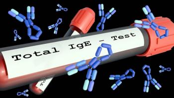 ImmunoglobulinE-Love Employee | Image Credit: © stock.adobe.com