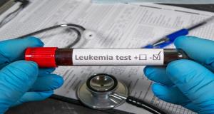 Leukemiatest | Image Credit: © Богдан Стеблянко-stock.adobe.com
