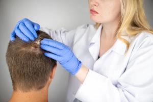 Trichologist examines hair of man | Image Credit: Siniehina - stock.adobe.com.jpeg