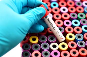 hepatitis c virus test