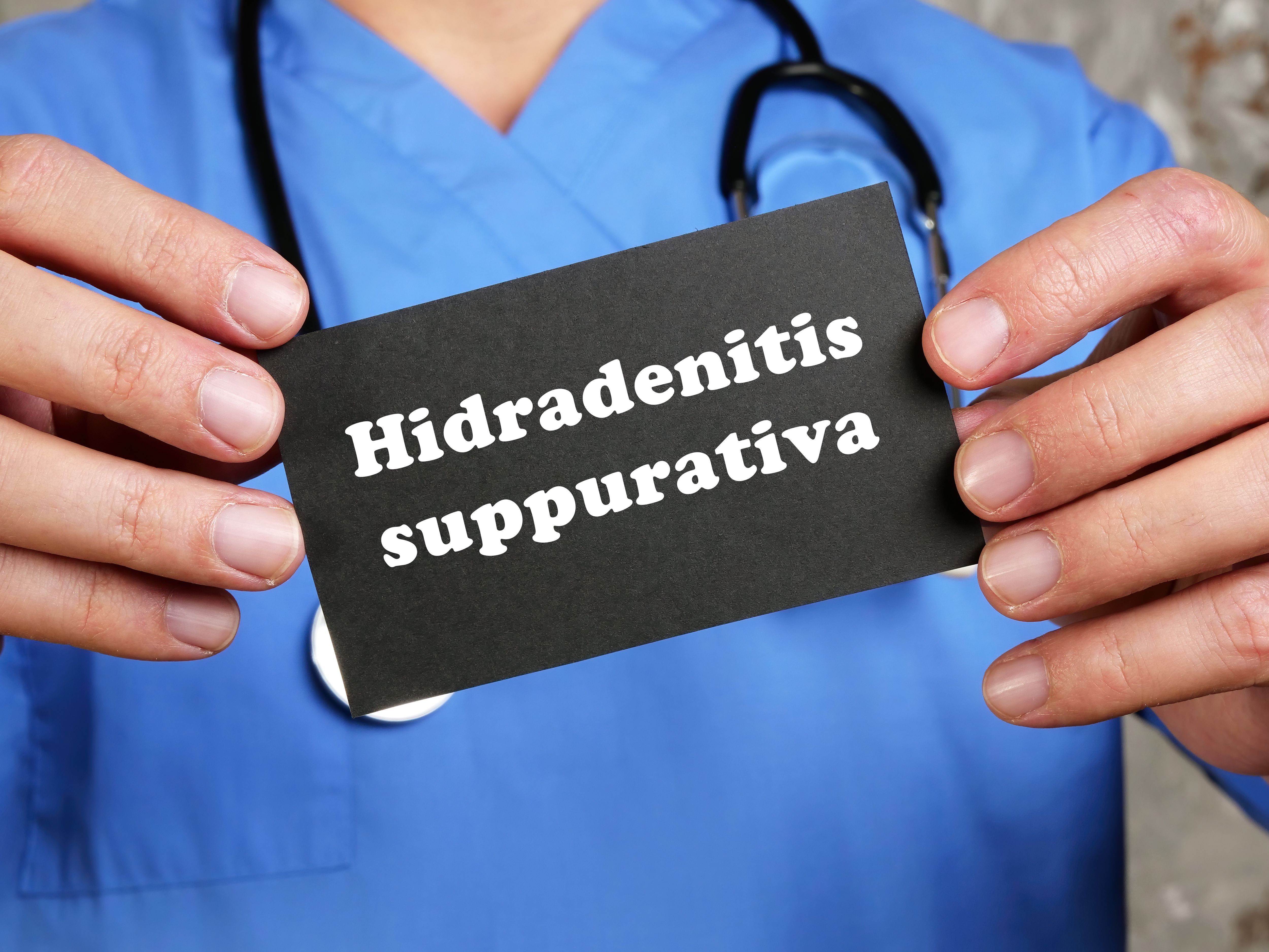 Hidradenitis suppurativa. | Image Credit: Yurii Kibalnik - stock.adobe.com 