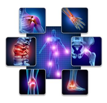 graphic depicting lupus