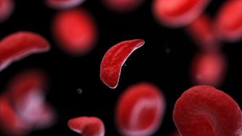 Experts discuss sickle cell disease subtypes, evolving therapies, and persistent barriers to equitable treatment access. | Image credit: @Sebastian Kaulitzki_adobestock.jpeg