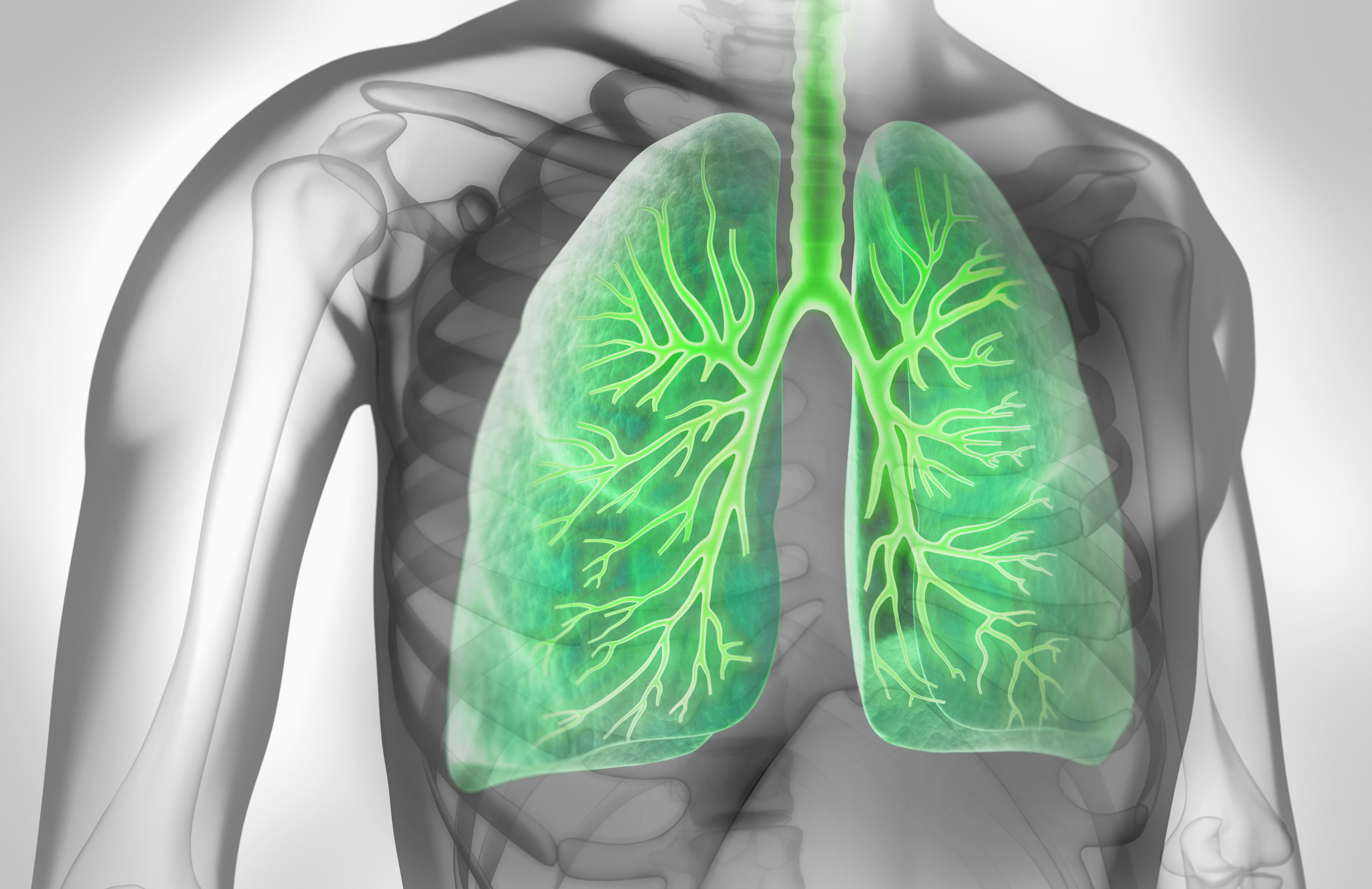 x-ray with lungs highlighted green