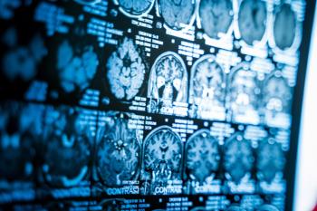 Study finds jurors were less likely to blame radiologists for errors when AI-assisted double reads were used in a mock malpractice case. | Image credit: @Vadim-adobe.stock.jpeg