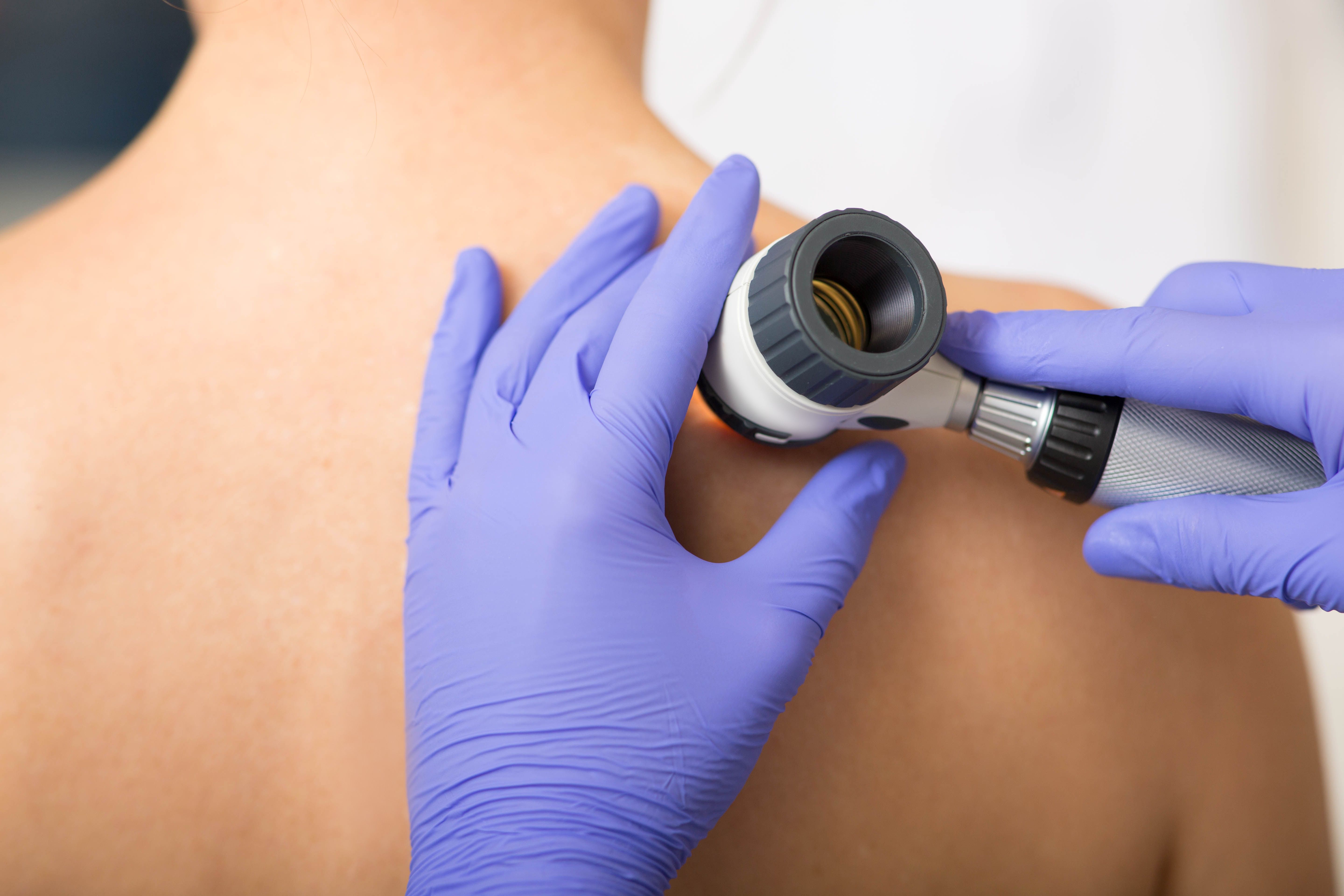 Clinician Performing Skin Examination | image credit: Peakstock - stock.adobe.com