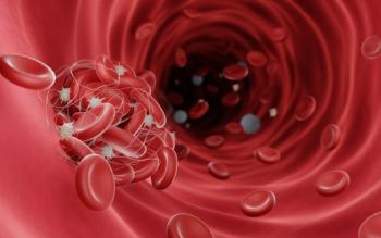 Clotting complications are a severe symptom of TTP | image credit: Artur - stock.adobe.com