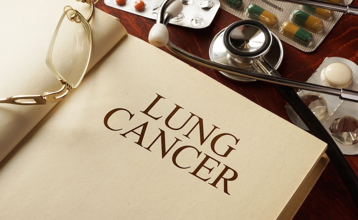 Lung cancer diagnosis | Image Credit: Vitalii Vodolazskyi-stock.adobe.com