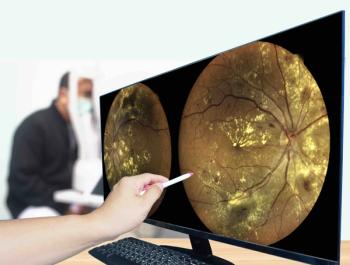 Imaging of the eye's retina | Image Credit: © Richman Photo - stock.adobe.com